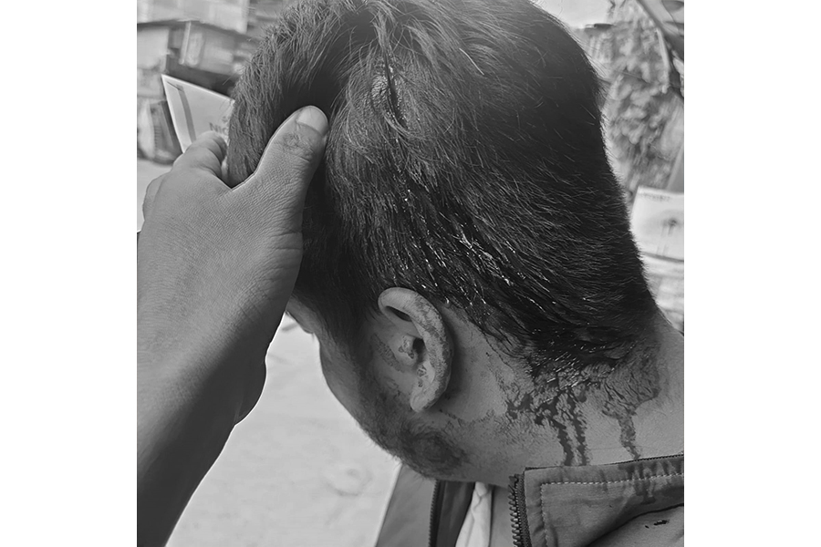 बैंकका कर्मचारीमाथि आक्रमण गर्नेलाई कारबाहीको माग
