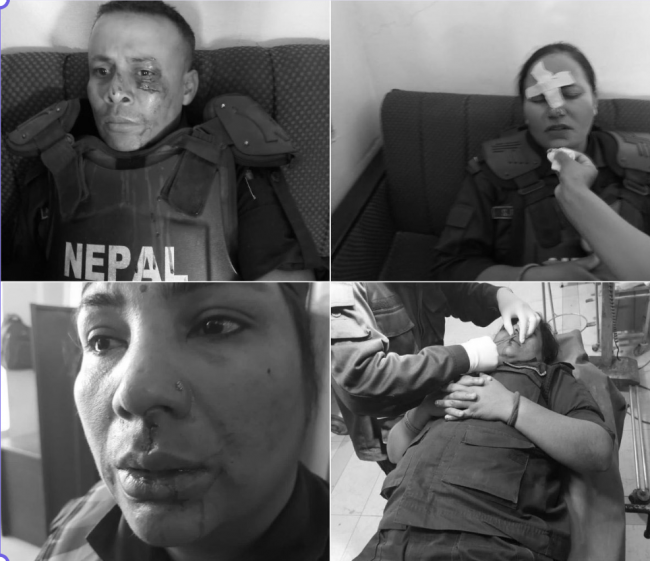 मिटरब्याज पीडित र प्रहरीबीच झडप हुँदा चार प्रहरी घाईते