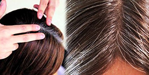 सेतो कपाललाई कालो बनाउने सजिलाे उपाय