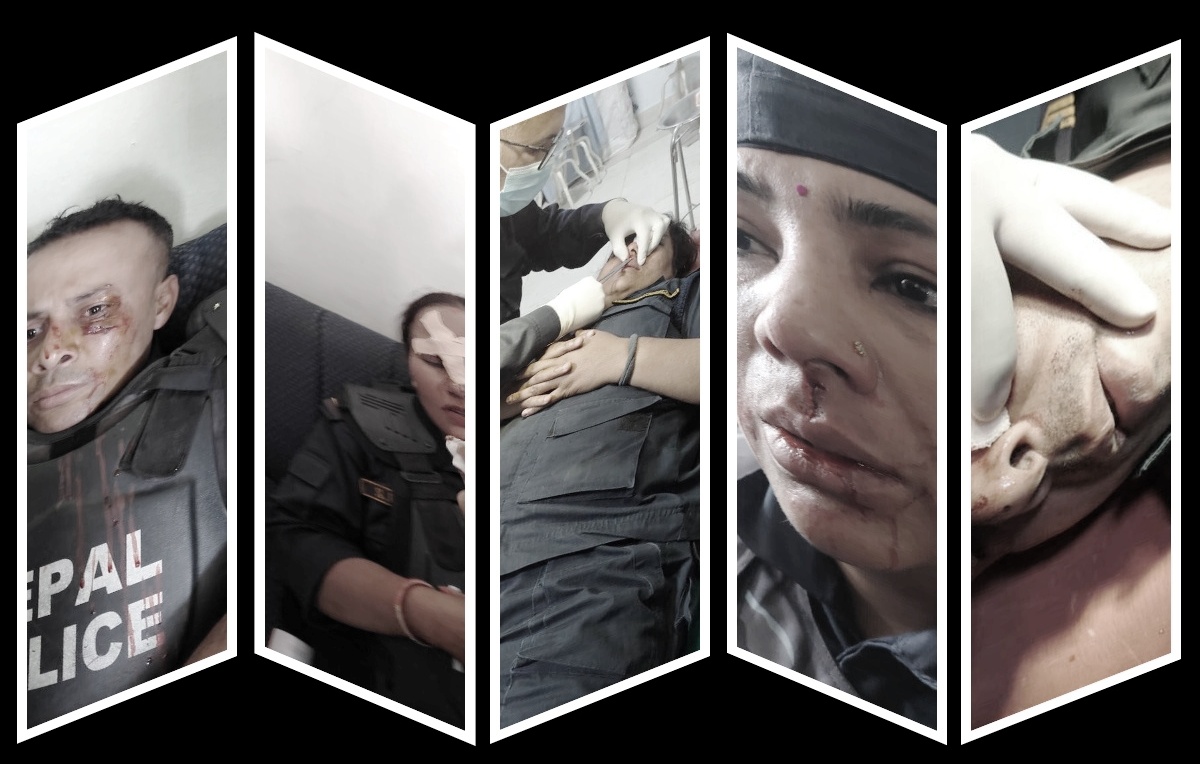 प्रहरी र मिटरब्याजपीडित झडप हुँदा चार जना प्रहरी घाईते