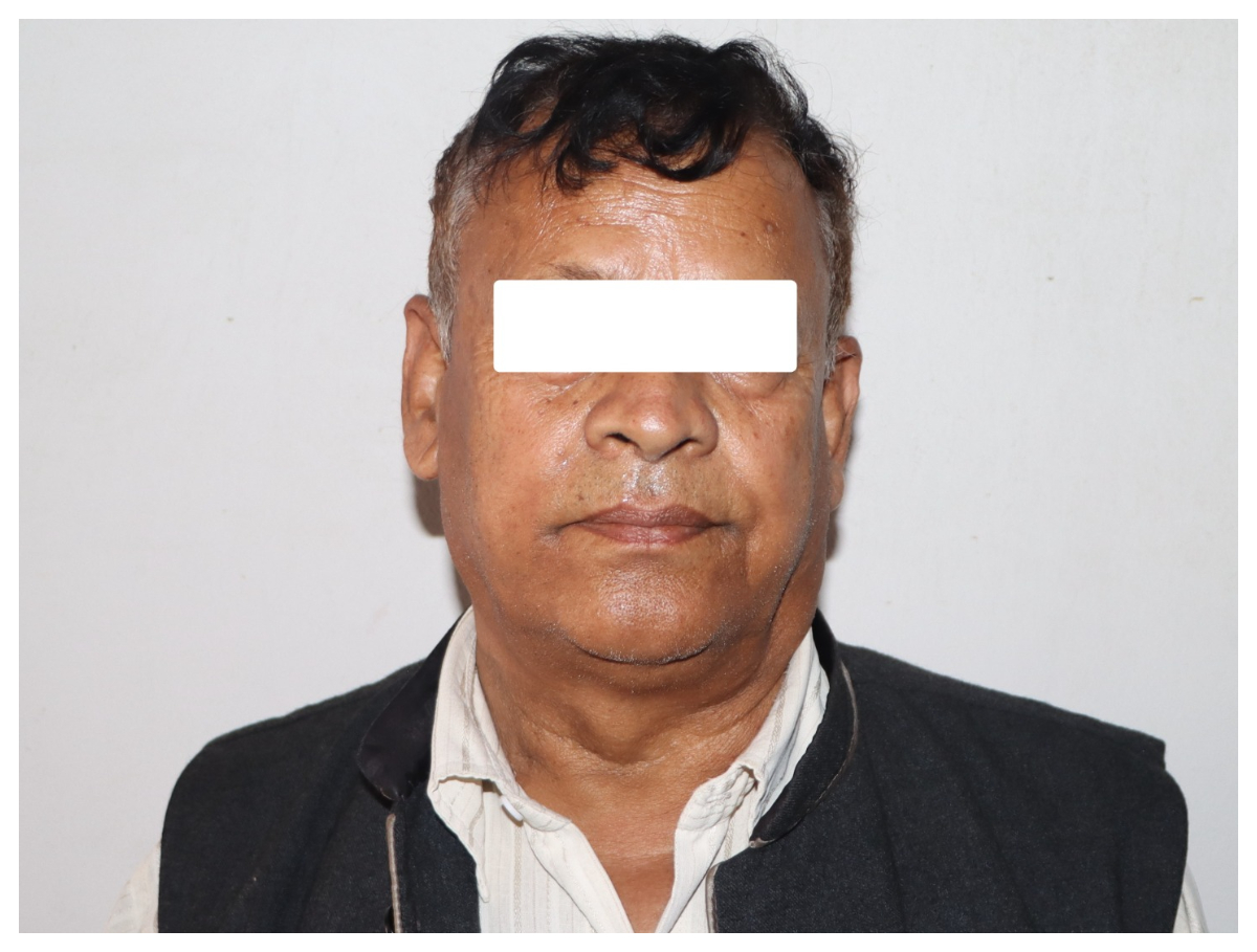 अमेरिका पठाउने भन्दै अर्को गिरोहको ठगी, एक सय एक जनाको करोडौँ फस्यो