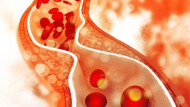 शरीरमा कोलेस्ट्रोल बढ्यो? यी फलफूल खान सुरु गर्नुहोस्