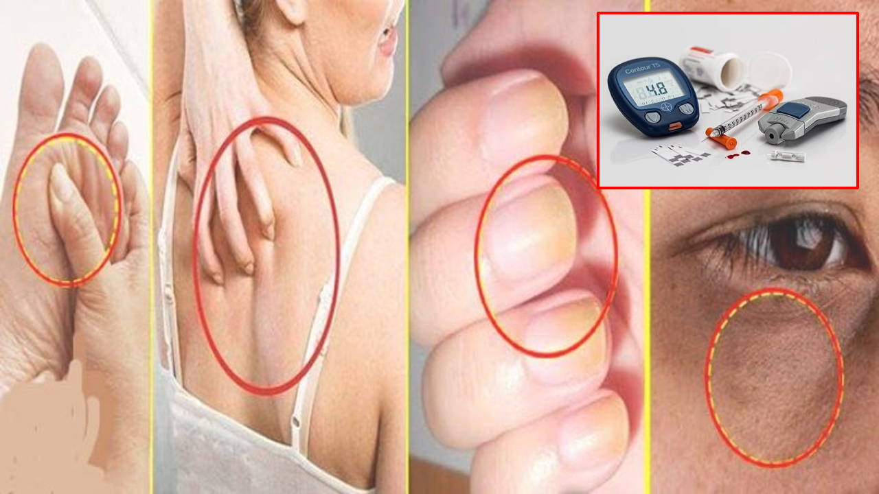 ब्लड सुगर घट्नु झनै खतरनाक, यसरी थाहा पाउनुहोस्