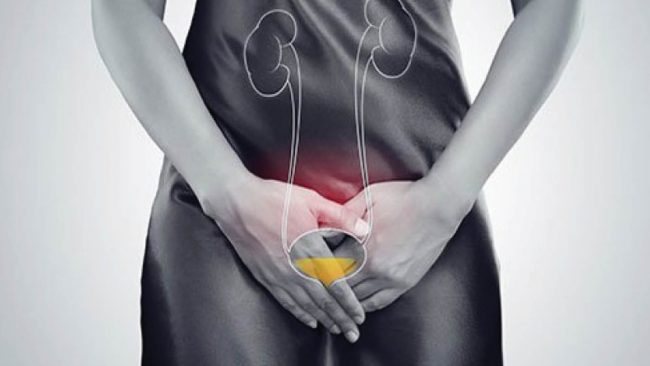 पिसाब गर्दा पोल्छ, दुर्गन्ध आउँछ? युरिनरी ट्र्याक्ट इन्फेक्सन भएको हुनसक्छ, यसो गर्नुहोस्