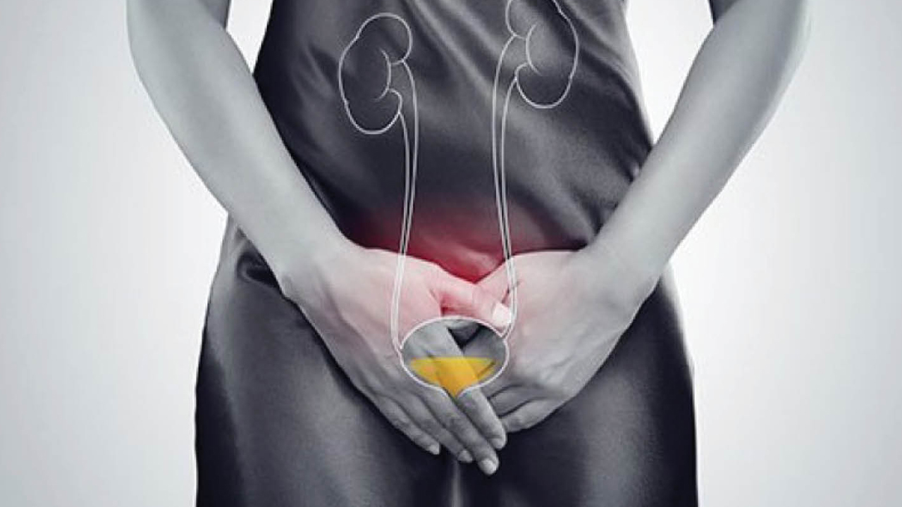 पिसाब गर्दा पोल्छ, दुर्गन्ध आउँछ? युरिनरी ट्र्याक्ट इन्फेक्सन भएको हुनसक्छ, यसो गर्नुहोस्