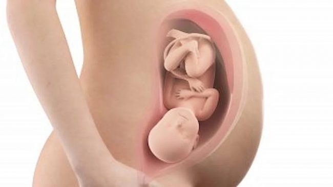 बच्चालाई बुद्धिमान बनाउन चाहनुहुन्छ ? गर्भावस्थामा यी ५ सुपरफुड खानुहोस्