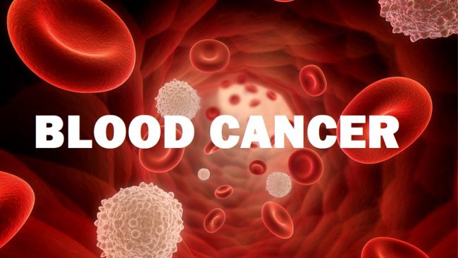 ब्लड क्यान्सर कसरी हुन्छ ? प्रारम्भमा देखिन्छ यस्तो लक्षण