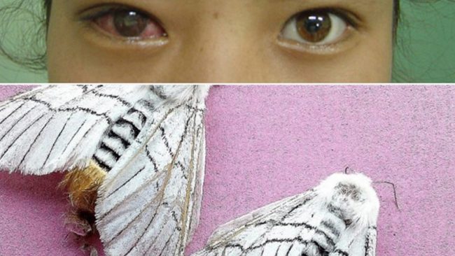 पोखरामा ‘सापू’ का बिरामी बढे