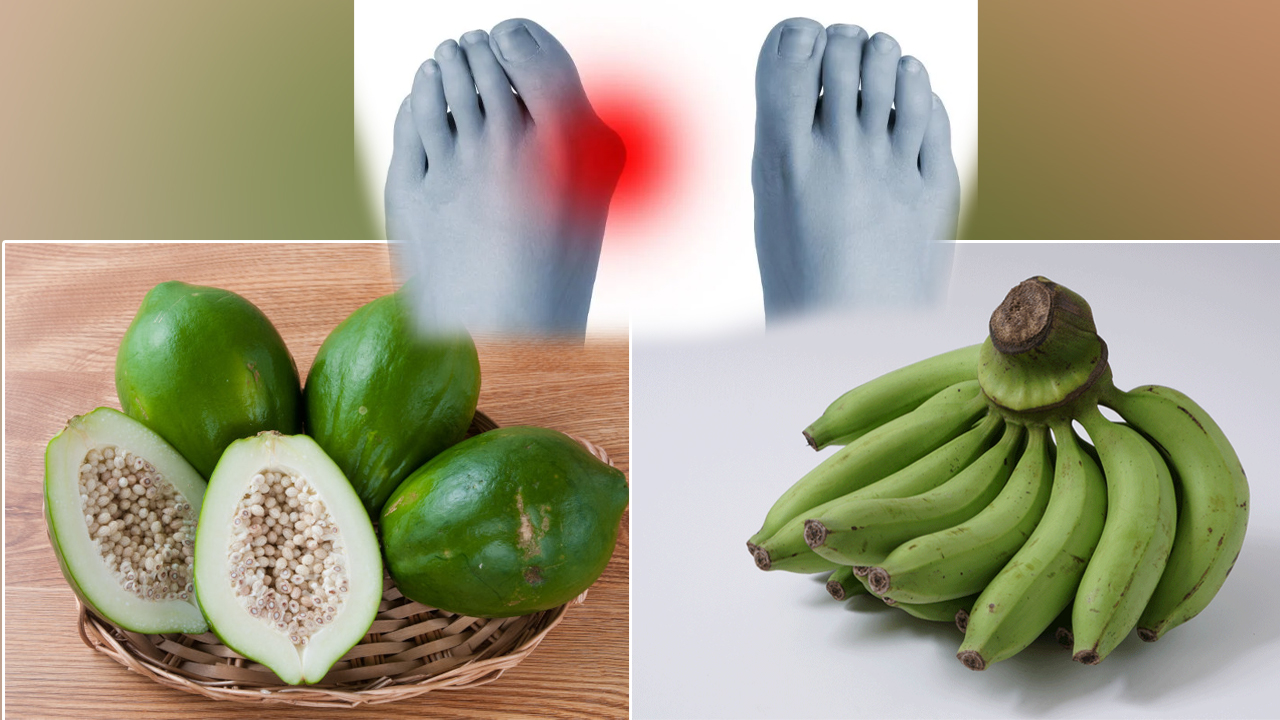 युरिक एसिडका रोगीले खानुहोस् यी दुई फल काँचो, पाइन्छ यस्तो फाइदा