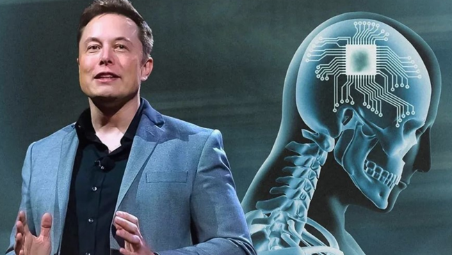 एलन मस्कले गराए मानव मष्तिष्कमा चिप प्रत्यारोपण