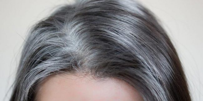 सानै उमेरमा बालबालिकाको कपाल सेतो हुनबाट जोगाउन यी ५ चिज खुवाउनुहोस्