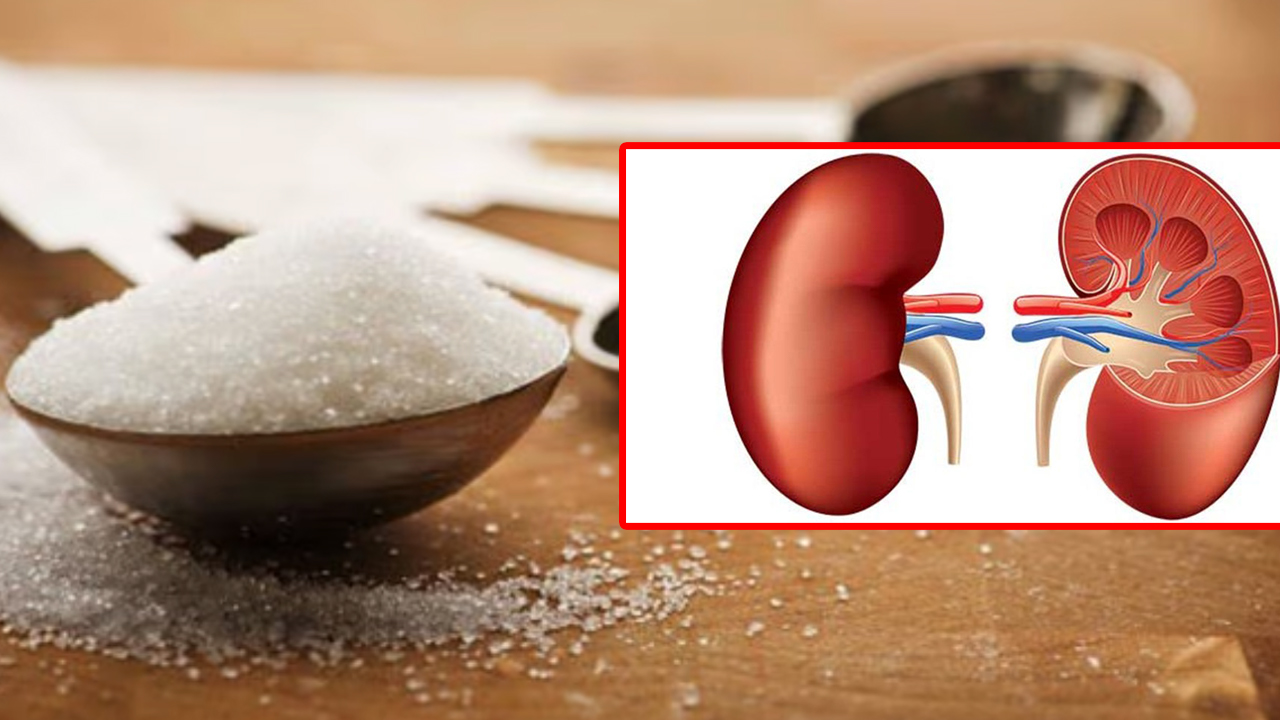 चिनीको सेवन मिर्गौलाका लागि हुन्छ हानिकारक, आजै सुधार्नुहोस् यी बानी