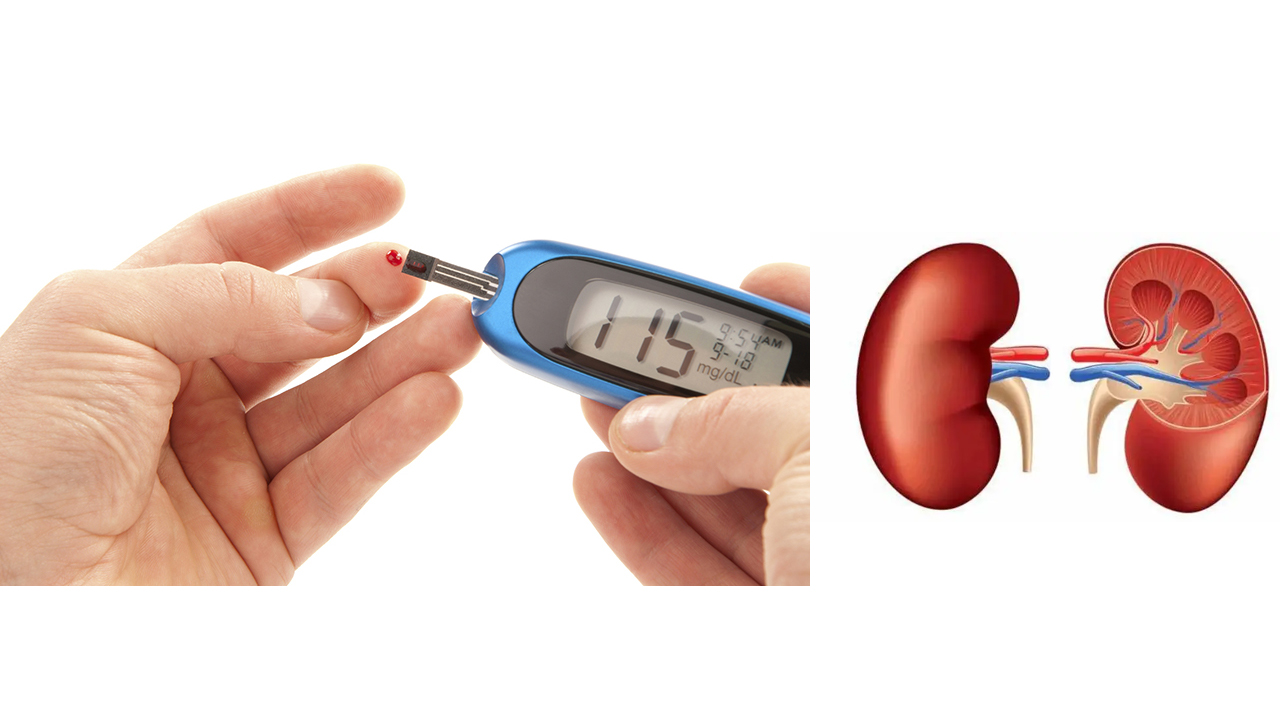 मधुमेहका बिरामीमा मृगौला रोगको सम्भावना उच्च, यसरी राख्नुहोस् आफ्नो ख्याल