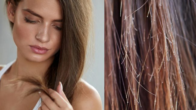 कपालमा हाँगा फाटेर बढ्न सकेनः यसरी हटाउनुहोस्