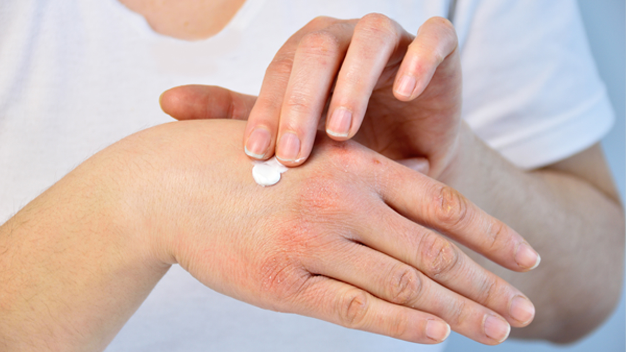 हातको छालालाई बुढ्यौली हुनबाट जोगाउन यसो गर्नुहोस्