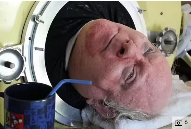 ७० बर्ष देखी फलामको बक्सामा रहेका ‘आयरन लंग मैन’ को निधन