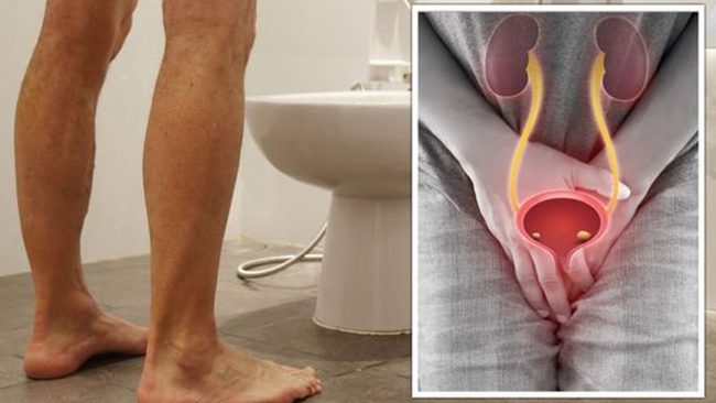 राति बारम्बार शौचालय जानुहुन्छ? यी रोगका लक्षण हुनसक्छ! तुरुन्तै परीक्षण गराउनुहोस्