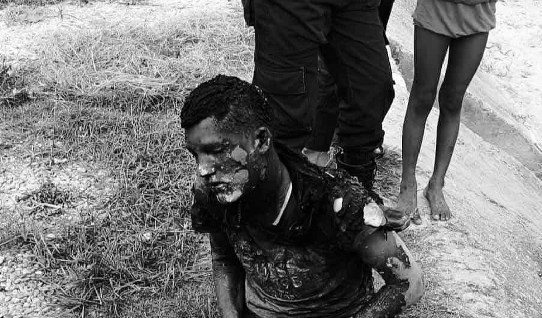 रुबी साह हत्या प्रकरणका मुख्य आरोपी शरीर जलेको अवस्थामा पक्राउ