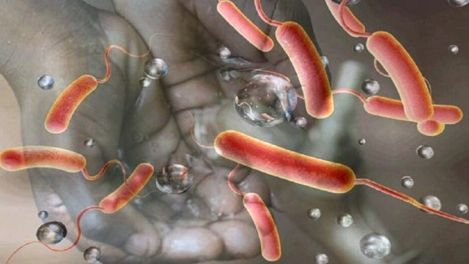 वीरगञ्जमा हैजाको त्रास, ९३ मा संक्रमण पुष्टि