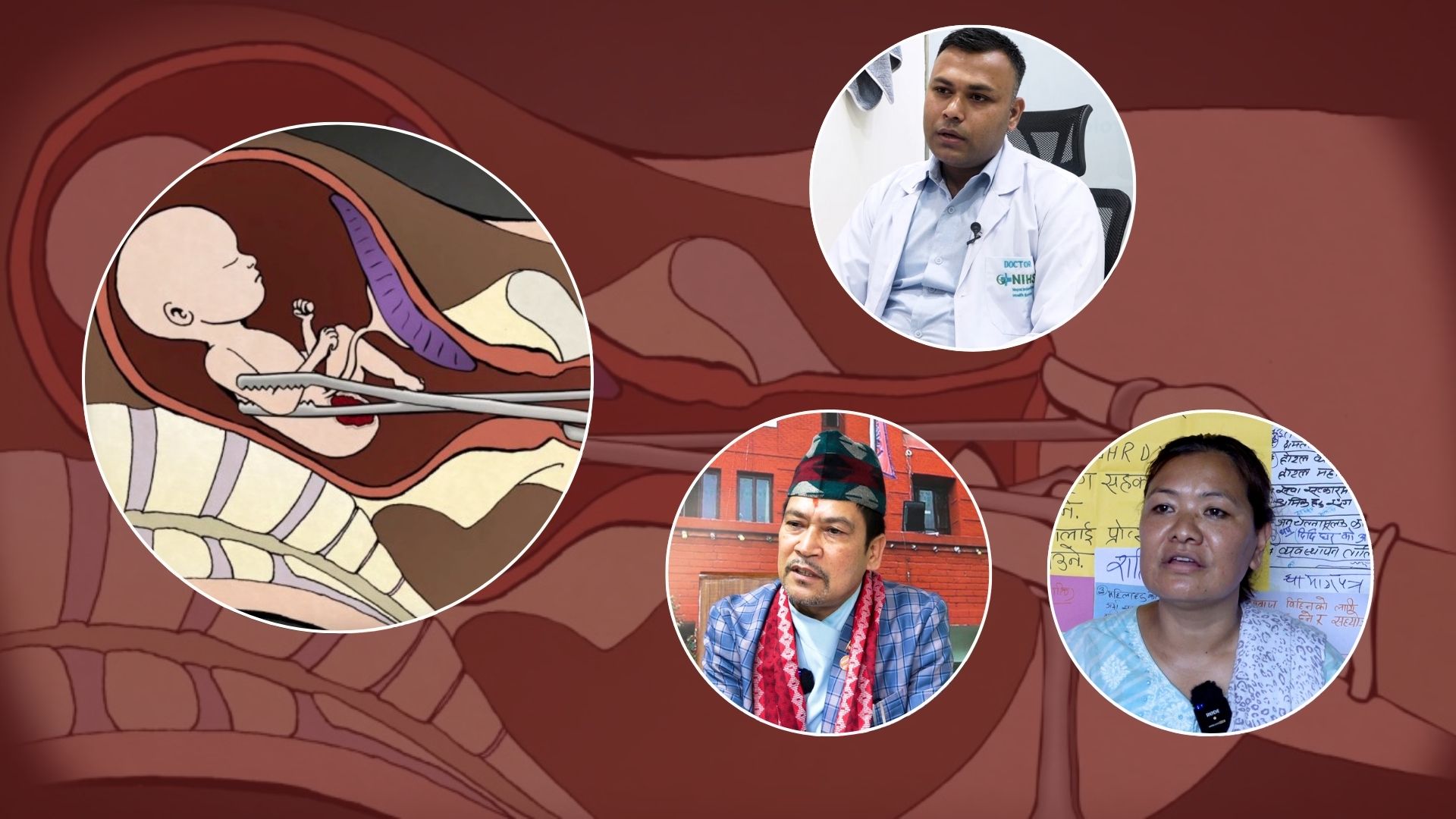 नेपालमा असुरक्षित गर्भपतन बढ्दो, सरकार र समाज मौन