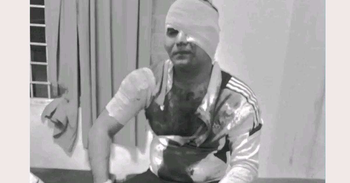 जेन जी आन्दोलनसँग संलग्न भएको आरोपमा एकजनामाथि खुकुरी प्रहार