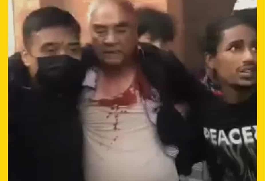 देउवा दम्पत्तिमाथि निर्घात कुटपिट