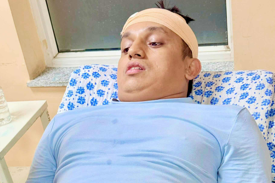 रास्वपा नेता बदन भण्डारीमाथि आक्रमण