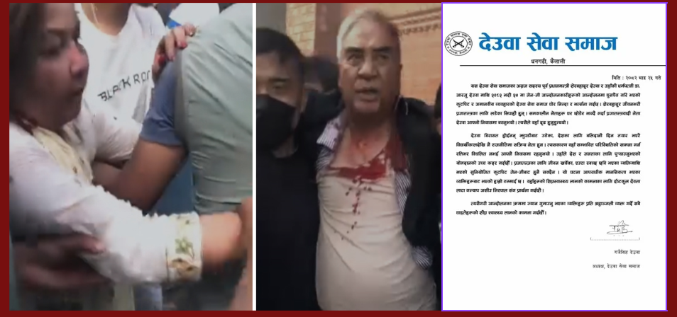 देउवा दम्पत्ति आक्रमणको निन्दा : बिरासतबाट नभइ झुपडीबाट उठेको नेताका रुपमा चित्रण