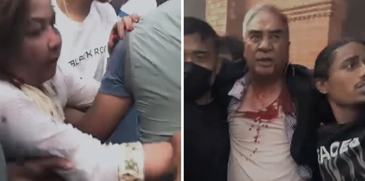 देउवाको टाउकोमा धारिलो हतियार प्रहार, १२ वटा टाँका लगाइयो