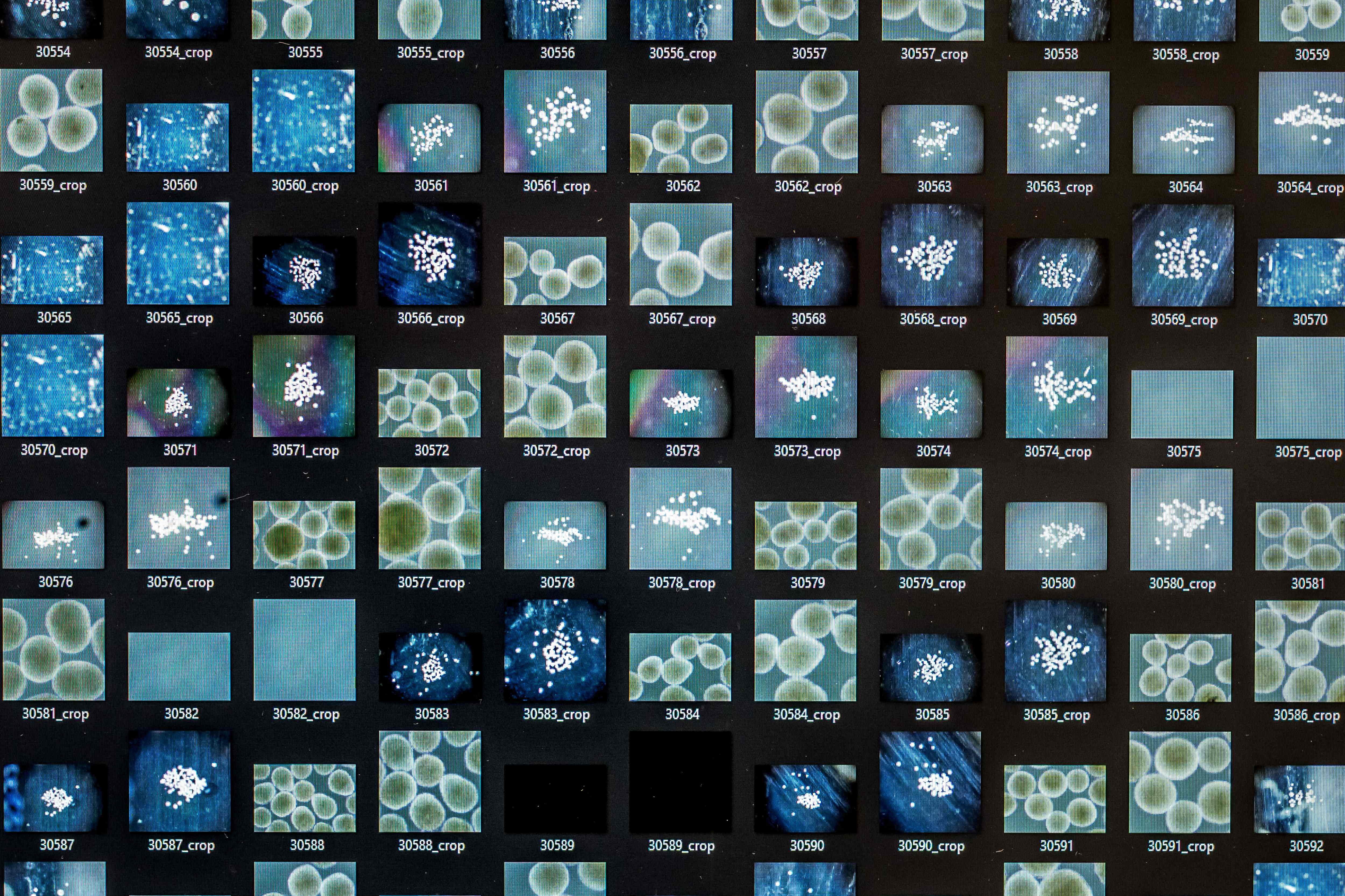 मानव मिनी-मस्तिष्कले चलाउँदैछ नयाँ पुस्ताको कम्प्युटर ‘वेटवेयर’