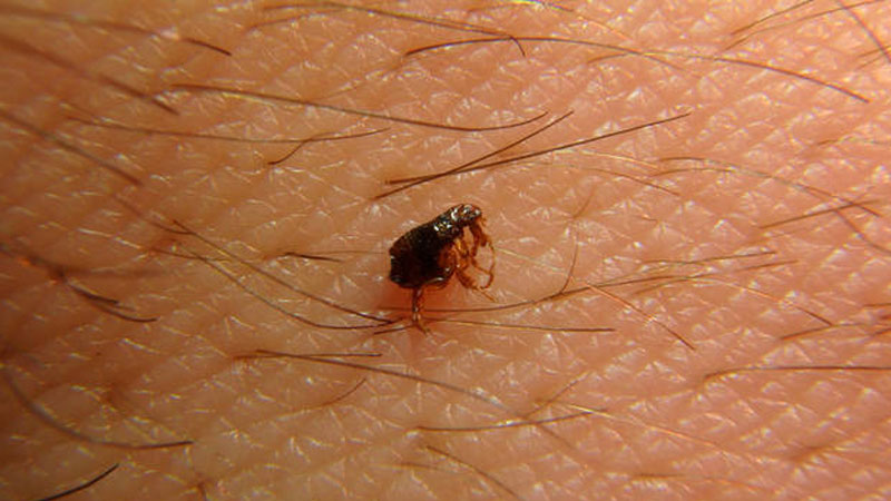 दुई सय ४६ जनामा स्क्रब टाइफसको सङ्क्रमण