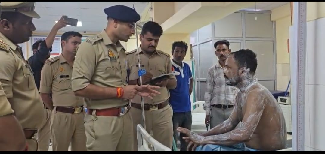 श्रीमतीसँग अवैध सम्बन्धको शंकामा आफन्तमाथि एसिड आक्रमण