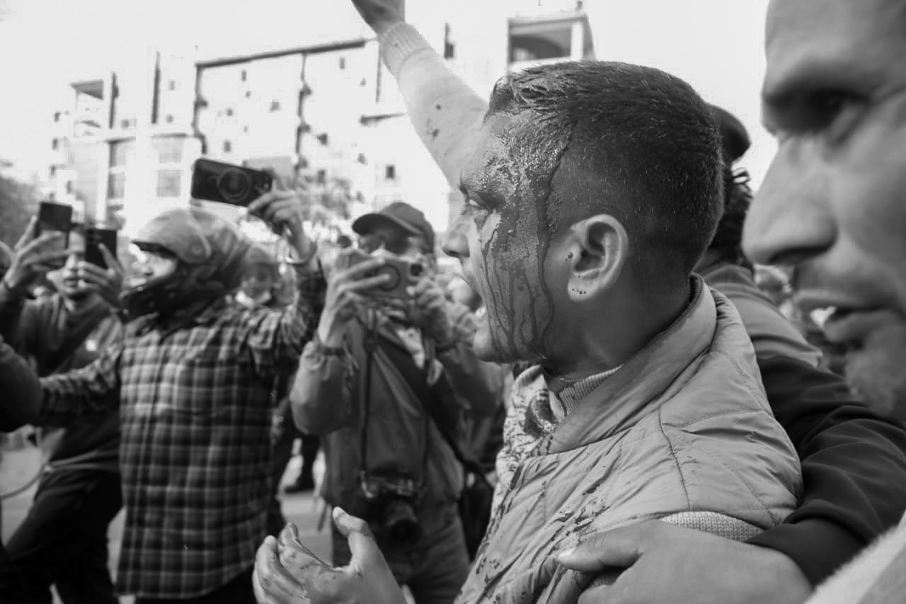 एमालेको प्रदर्शनले माइतीघर अस्तव्यस्त, केही आन्दोलनकारी घाइते(फोटो फिचर)